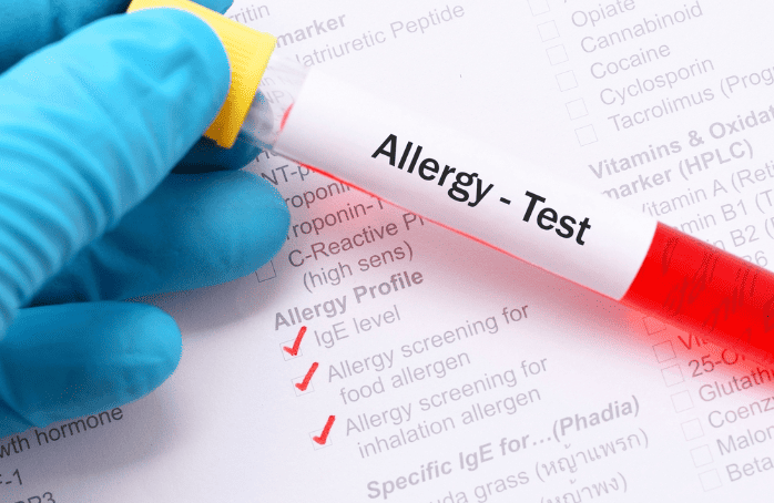 ​알레르기 혈액검사