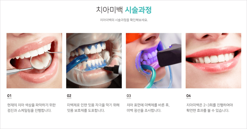 치아미백 과정