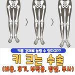 키 크는 수술