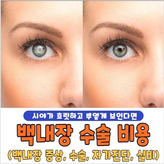백내장 수술 비용