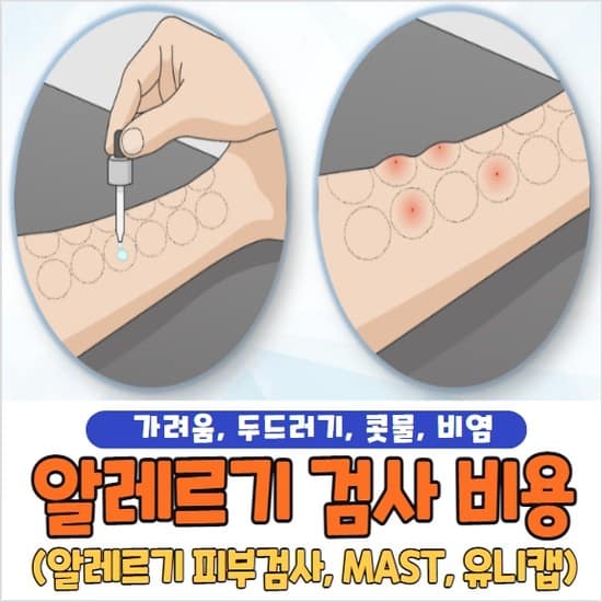 알레르기 검사 비용