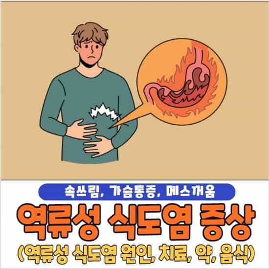 역류성 식도염 증상