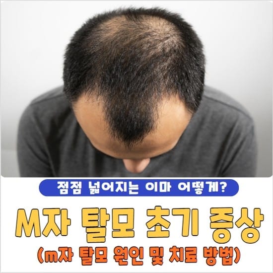 m자 탈모 초기 증상