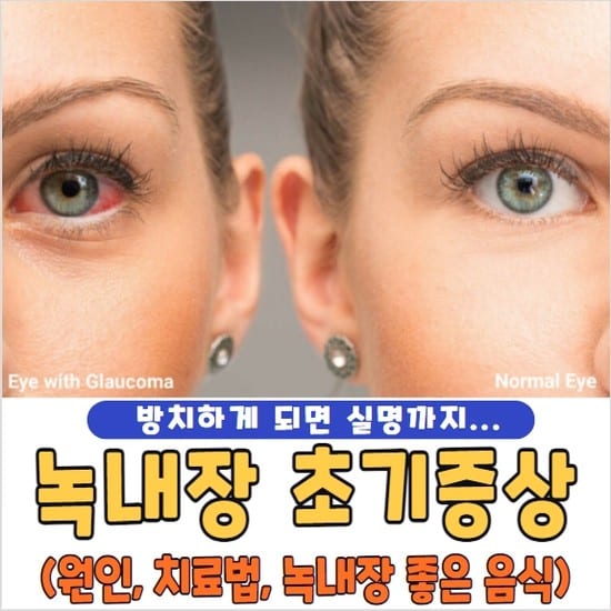 녹내장 초기증상