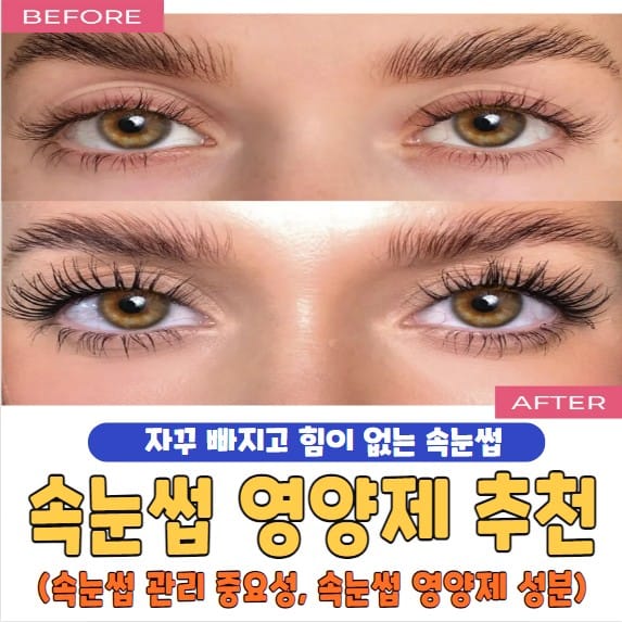 속눈썹 영양제 추천
