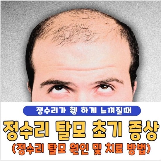 정수리 탈모 초기 증상