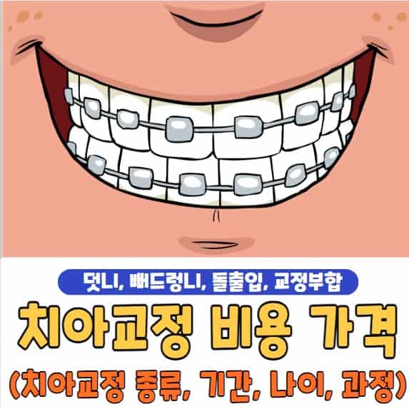 치아교정 비용
