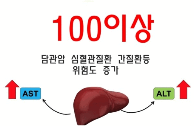 간장질환