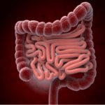 대장암 초기증상