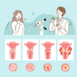 자궁경부암 증상