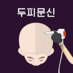 두피문신 가격