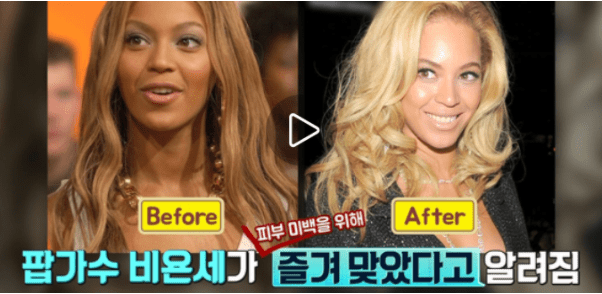 정맥으로 투여하는 글루타치온 성분 주사
