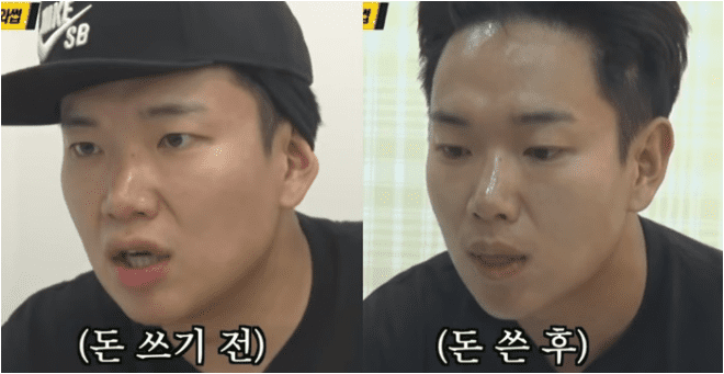 초음파와 고주파를 이용한 얼굴 탄력 레이저 시술