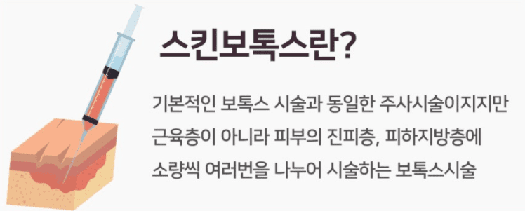 희석한 보툴리눔 톡신을 피부 얕은 층에 주사하는 시술